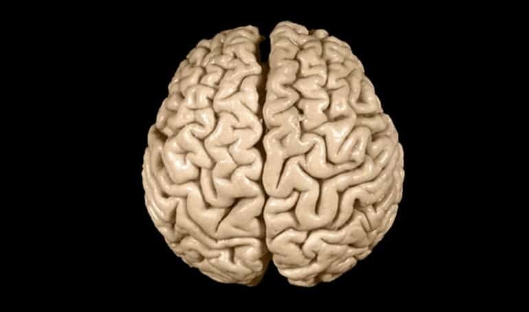 Einstein's Brain Einstein's Brain